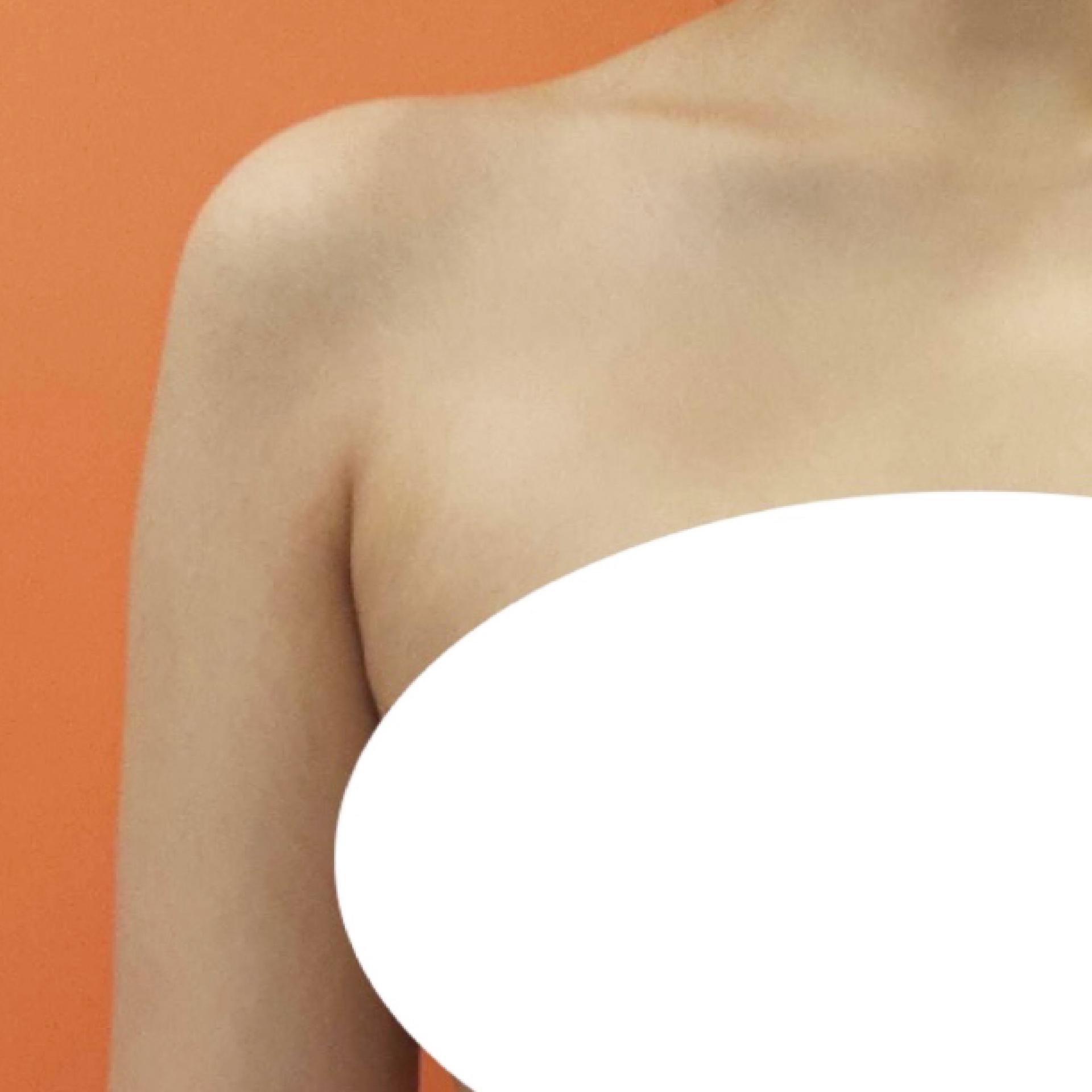 3 months after Armpit LAMS
