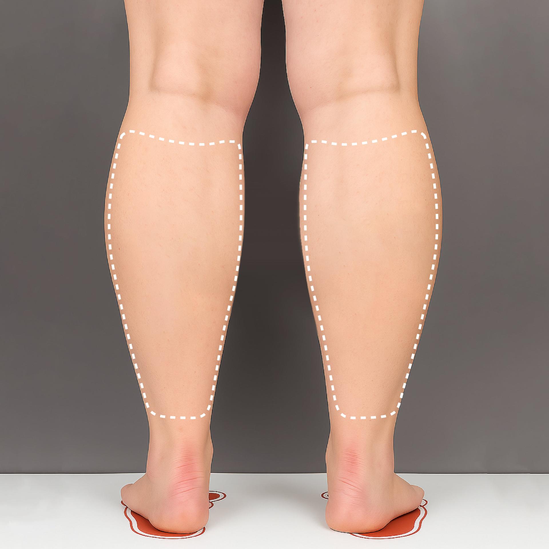 Before Calves LAMS