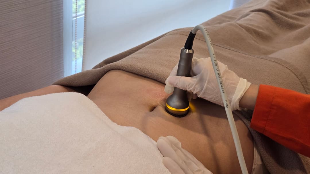 Fact or Myth: Weight Gain & Loss Can Cause Stretch Marks?